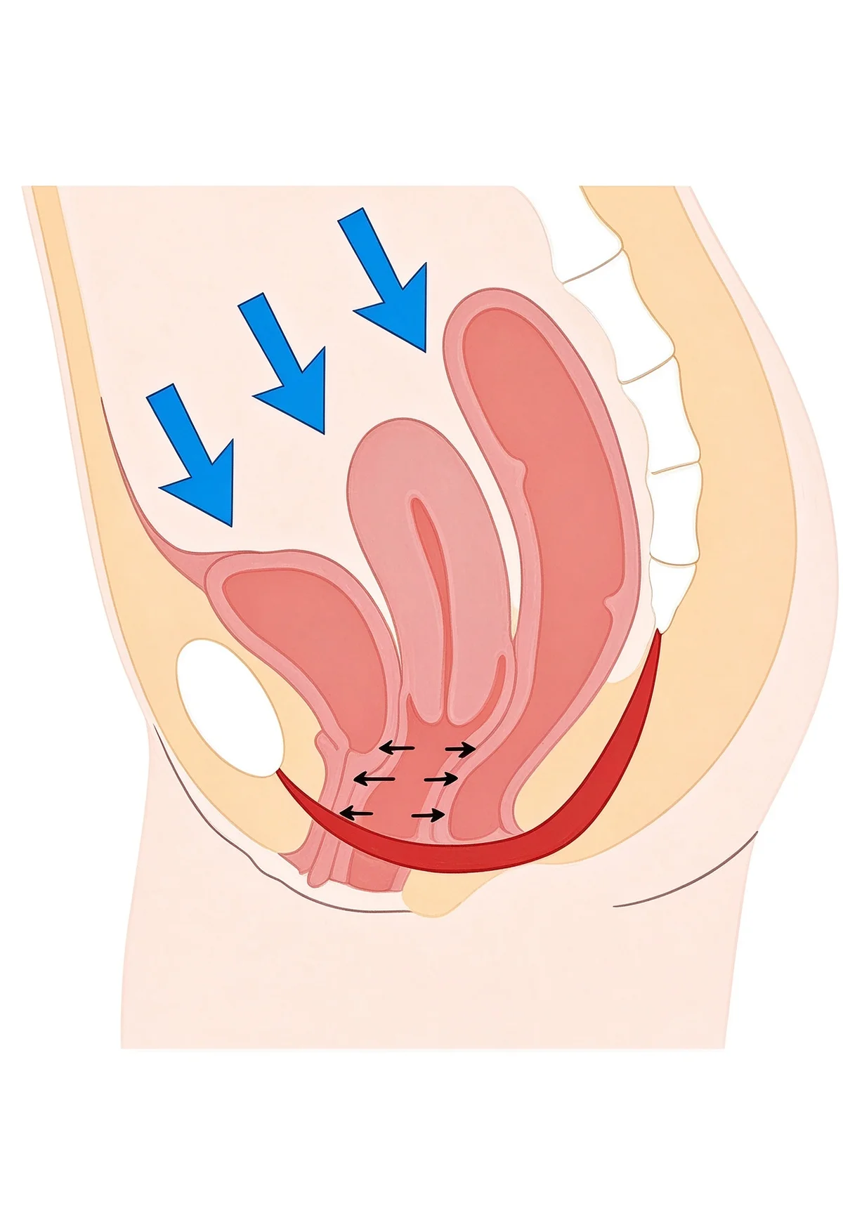 Pelvic Floor Rehabilitation