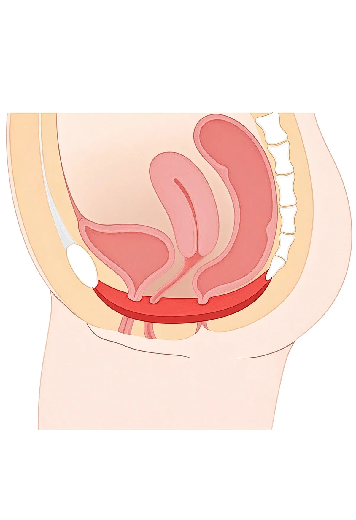 Pelvic Floor Rehabilitation